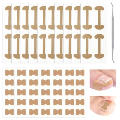 Image de 101 Pcs Ongle Incarné Kit,Kit De Correction D&#039;ongles Incarnés,Correction Des Ongles Orteils Incarnés,Orteil Kit Traitement Incarnés