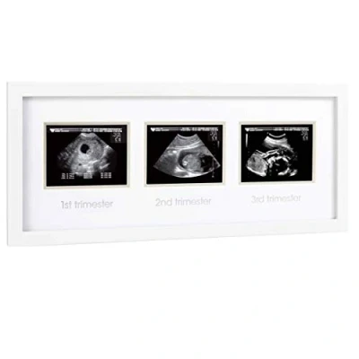 Image de Pearhead Pregnancy Trimester Sonogram Frame, Ultrasound Picture Milestone Keepsake Photo Keepsake, Gender Neutral Baby Nursery Décor, 1st 2nd and 3rd Trimester, White