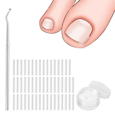 Image de zoerbufan Kit Correcteur d&#039;ongles Incarnés, 50 Pcs Correction Des Ongles Orteils avec lève ongles, Orteil De Traitement