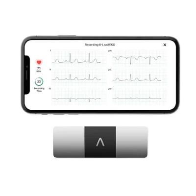 Image de AliveCor KardiaMobile 6L Le Moniteur ECG Personnel connecté à 6 dérivations. Détectez la Fibrillation auriculaire en Seulement 30 Secondes Tout Moment, n&#039;importe où.