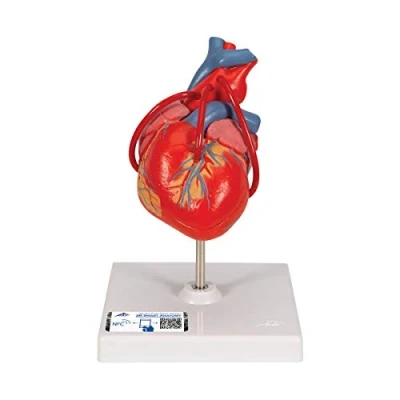 Image de 3B Scientific G05 Cœur classique, avec pontage, en 2 parties + Application anatomie gratuite Smart Anatomy