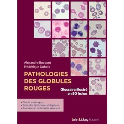 Image de Pathologies des globules rouges: Glossaire illustré en 50 fiches