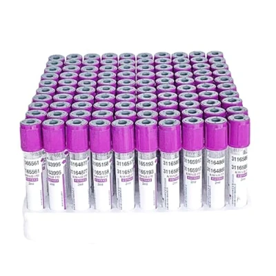 Image de COYEUX Tube de prélèvement sanguin sous Vide 100 pièces, Tubes en Verre EDTA K2 2 ML/5 ml/10 ML, avec Bouchon à vis Violet pour Laboratoire, Laboratoire