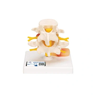 Image de 3B Scientific A76 Modèle de Vertèbres Lombaires avec Prolapsus des Disques Intervertébraux + Application anatomie gratuite Smart Anatomy