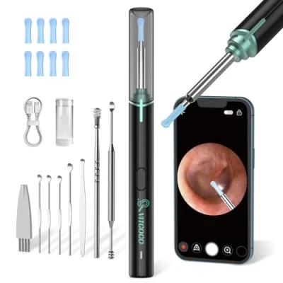 Image de VITCOCO Otoscope Oreille 1920P HD Camera IP67 étanche Nettoyage Portable avec 6 LED Nettoyeur Adapté aux Smartphones et Tablettes IOS Android (Noir)