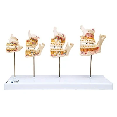 Image de 3B Scientific D20 Développement de la Dentition + logiciel d&#039;anatomie gratuit Smart Anatomy