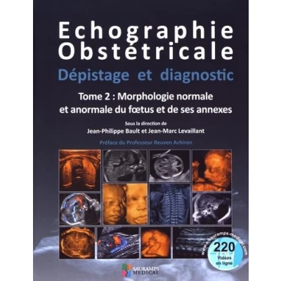 Image de ECHOGRAPHIE OBSTETRICALE. DEPISTAGE ET DIAGNOSTIC T2 MORPHOLOGIE NORMALE &amp; ANORM