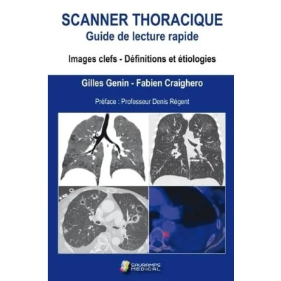 Image de SCANNER THORACIQUE. GUIDE DE LECTURE RAPIDE: IMAGE CELFS. DEFINITION ET ETIOLOGIES