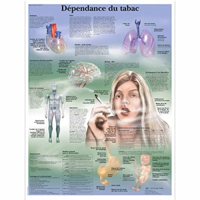 Image de 3B Scientific VR2793L Planche Anatomique, Dépendance du Tabac